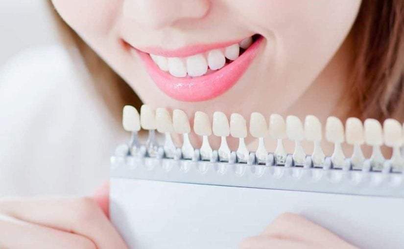 How Are Porcelain Veneers Effective By Professional Dentists?